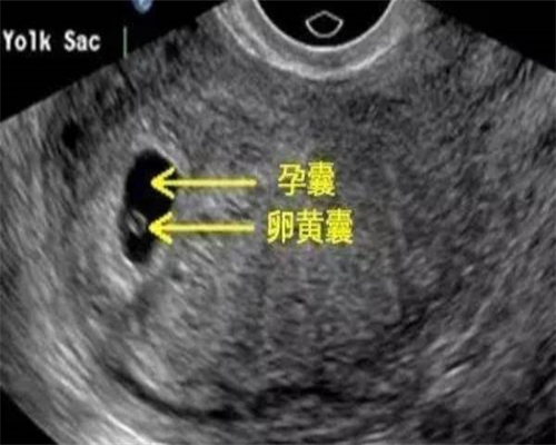 如何有效保养卵巢与输卵管以维护女性生殖健康